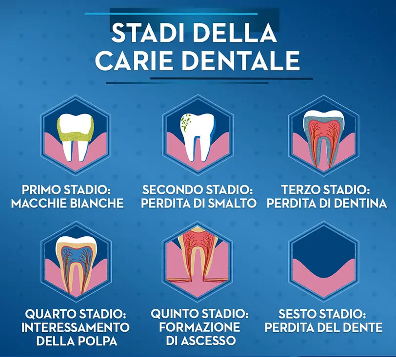 STADIDELLECARIE_DENTISTAMARZULLIBARI