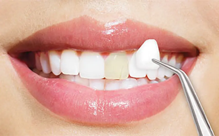 dentistamarzullibari_eccellenza implantologia protesi ortodonzia